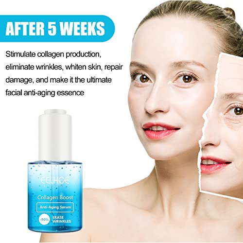 Youngerme Collagen Boost Anti-Aging Serum, Younger me Collagen Boost Serum, Collagen Boost Anti Aging Serum 90% Collagen Booster Erase bore, 1fl oz
