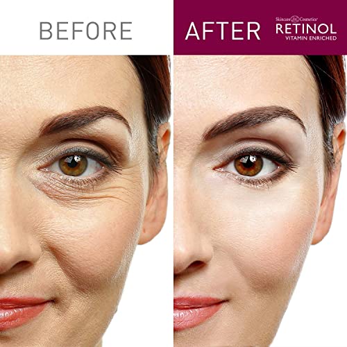 Retinol skin Brightener-originalni brend Retinol-korektor tona kože Smooths & pomlađuje lice za zdrav sjaj – minimizira Fine linije & bore sa ekstraktima biljaka & voća, vitamina A, C & amp; E