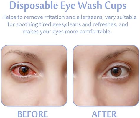 Jednokratne šalice za pranje očiju za osvježavanje i čisto umor - 100 kom. Prijenosne šalice za čišćenje očiju, bez sterilnog