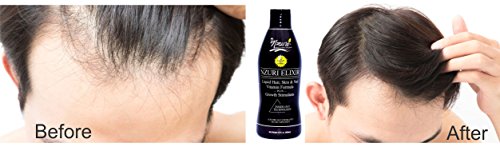 Nzuri Elixir - tečni stimulansi rasta vitamina Plus za kosu 2-32 Oz bočice