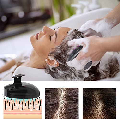 Sosoon Scalp Massager šampon četka, meka silikonska kosa Scalp piling Scrubber za muškarce žene djeca rast kose