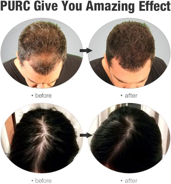 2 kom 300ml Šampon za zadebljanje kose Muškarci Ženska gušterska trečiva za monku protiv pada kose promovira šampon za rast kose